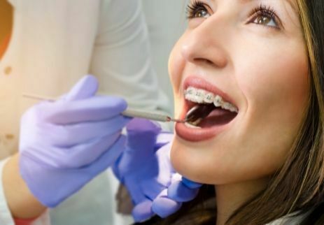 Diş Teli Tedavisi Nasıl Yapılır