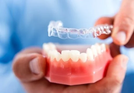 İnvisalign Tedavisi Ne Kadar Sürer