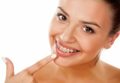 Ortodontik Tedavide Kullanılan Braket Çeşitleri Nelerdir